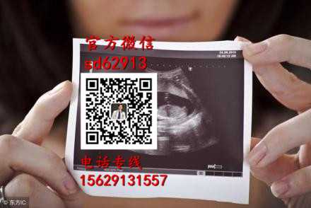 广州世纪试管代怀孕-怀孕7周hcg正常值是多少