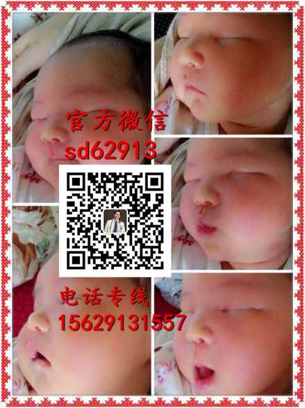 广州代生宝宝包男孩-孕早期需