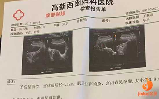 去代孕需要多少费用-广州三代试管包生儿子_【医院供卵可不可以挑选】记录一