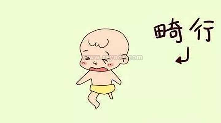 广州代孕找什么人合适-中国试管婴儿合法代孕_做二代试管婴儿优点有哪些？有