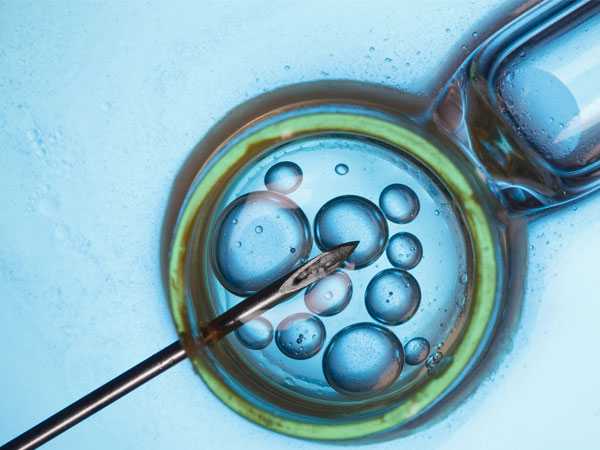 为什么说做二代试管移植优胚的都是生儿子？